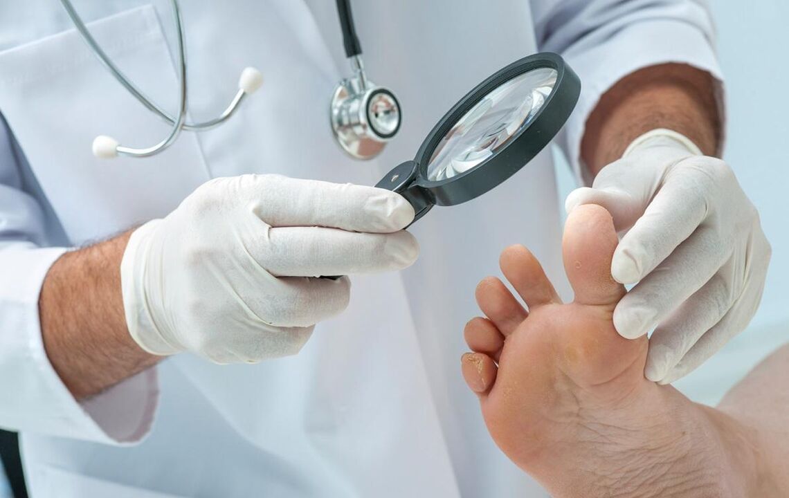 врач осматривает ноги при грибке
