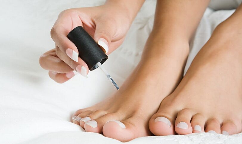 нанесение лака для лечения грибка на ногтях ног